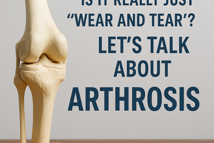 Anatomical knee model used to explain arthrosis treatment and joint pain.